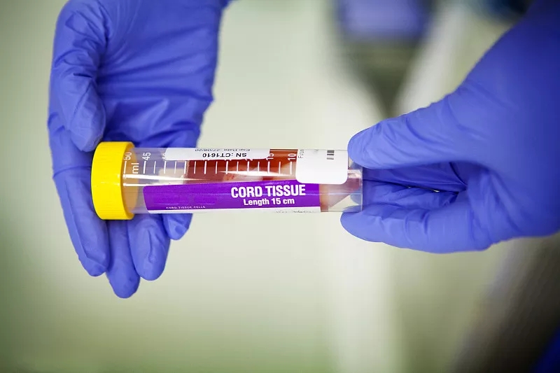 間充質(zhì)干細胞的優(yōu)點有哪些？