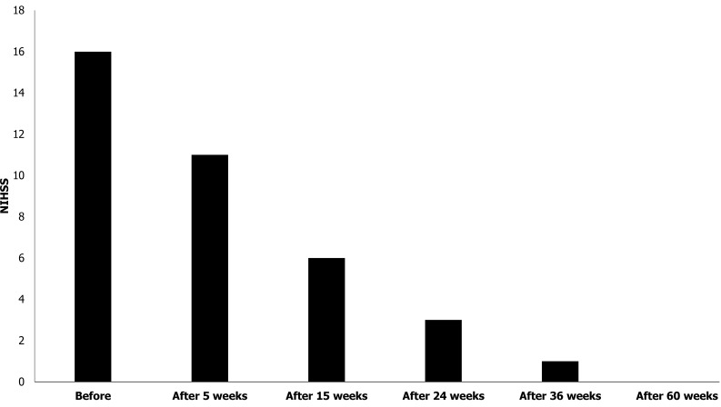 圖3：患者的美國國立衛生研究院卒中量表評分。在第一次治療后的60周內，患者的美國國立衛生研究院卒中量表評分逐漸下降。