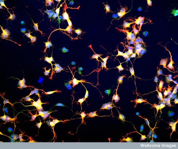 中科神經干細胞 中科神經干細胞