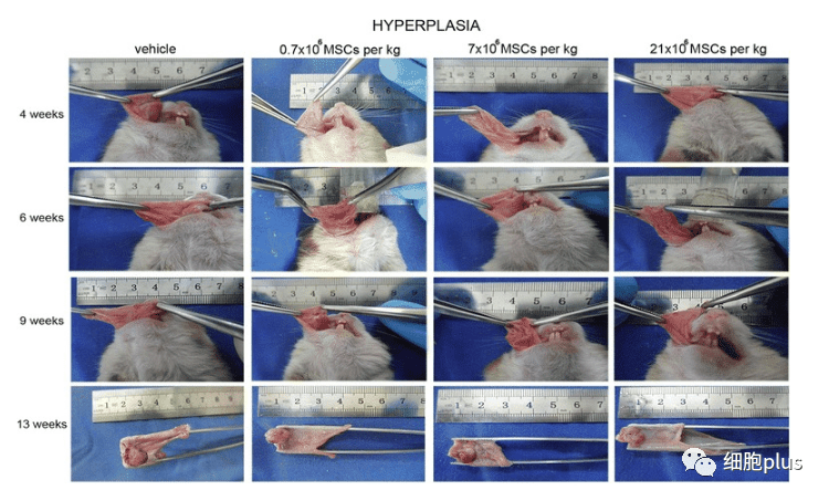 全身注射同種異體間充質(zhì)干細胞不會加速癌前病變的進展