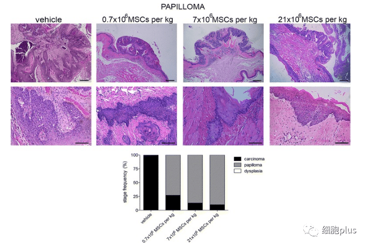 在非典型增生期，全身注射同種異體間充質(zhì)干細胞不會增加腫瘤的惡性程度。