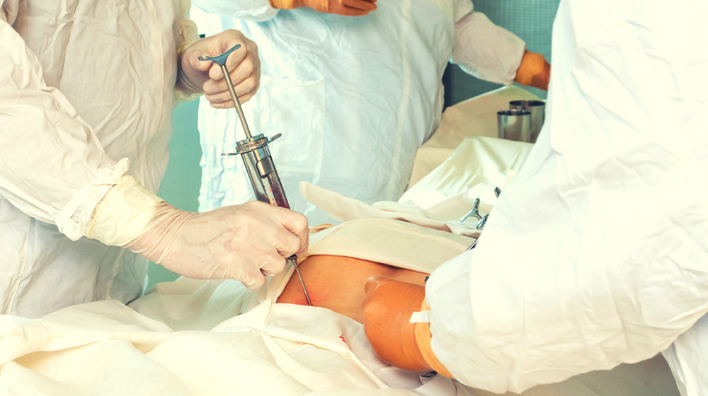 關于自體干細胞移植的須知