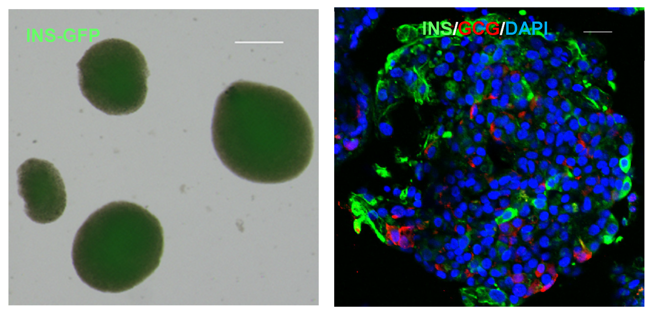 圖1顯示了人類多能干細(xì)胞 (hPSC) 衍生的胰島器官的圖像