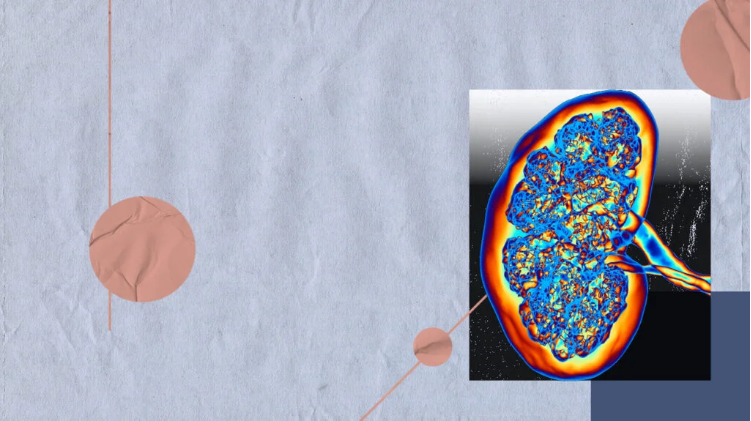 急性腎損傷與腎衰竭：它們有何不同？