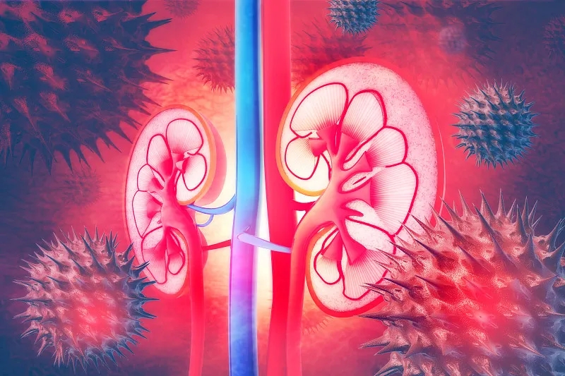 常見問(wèn)題解答：IgA腎病的進(jìn)展