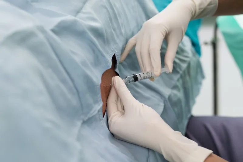 干細胞，-鞘內給藥，-神經系統疾病