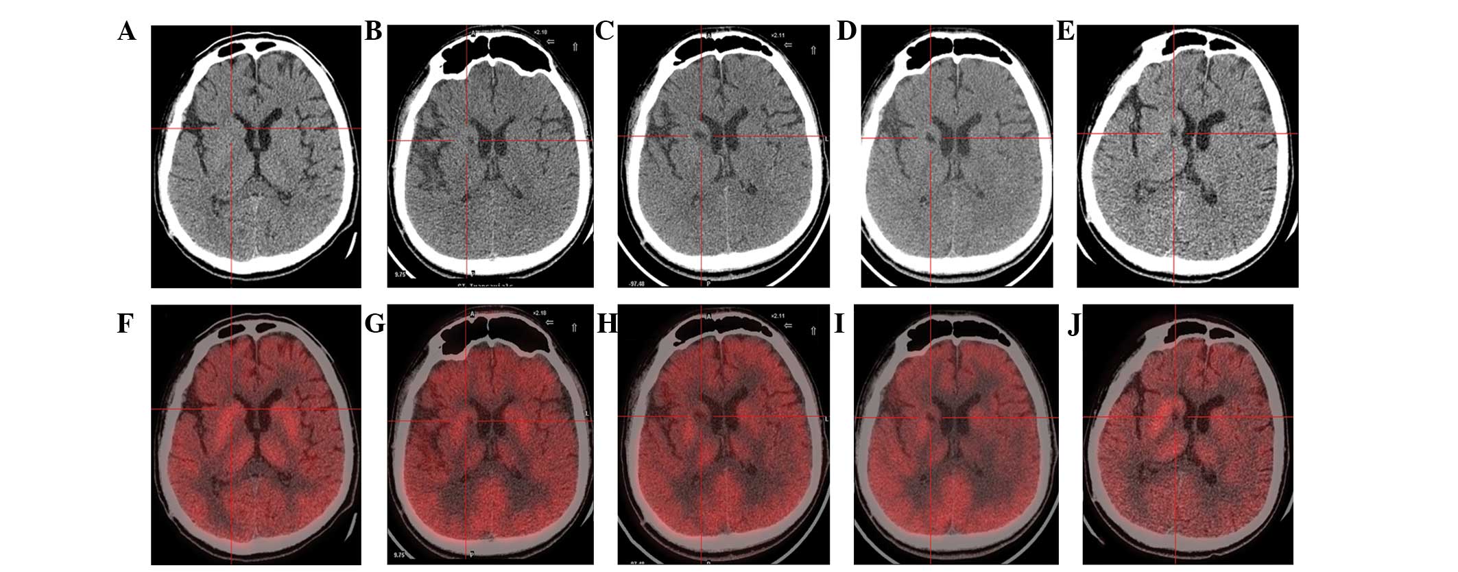 圖1：計算機斷層掃描 (CT) 和正電子發射斷層掃描 (PET) 掃描。