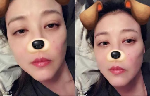 △ 周海媚之前發布的自拍照中也隱約可見面部紅斑