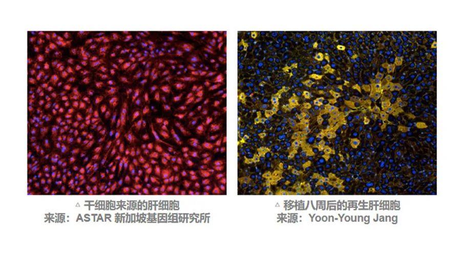 MSC有望通過不同途徑調動肝臟細胞再生來改善預后。 MSC有望通過不同途徑調動肝臟細胞再生來改善預后。