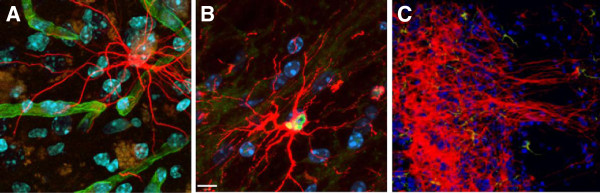 圖3：人類中樞神經系統干細胞 (HuCNS-SC) 根據其遷移位點優先分化為特定譜系。