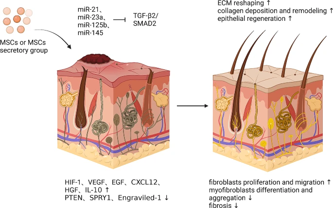 圖6：間充質干細胞促進皮膚疤痕修復的機制。