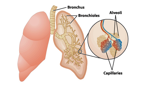 慢性阻塞性肺病如何影響肺部？