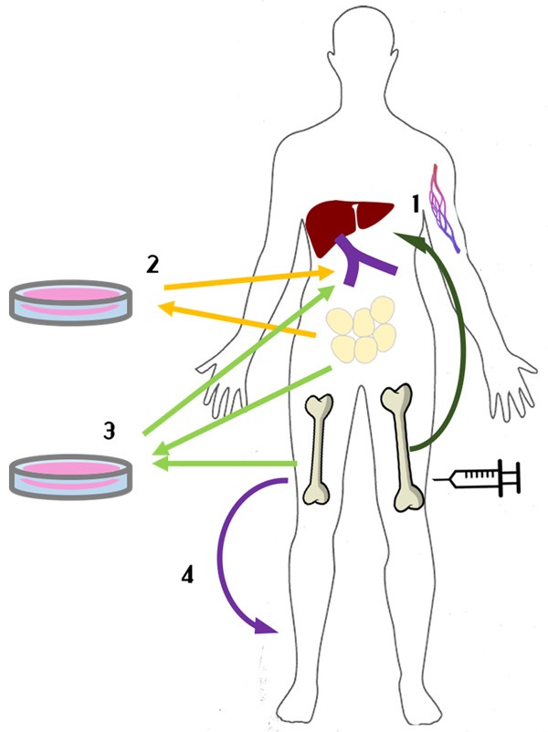 圖1：間充質干細胞治療1型糖尿病方法示意圖。