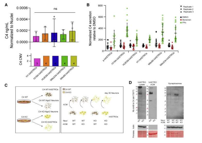 2023年干細胞治療精神分裂癥臨床案例 2023年干細胞治療精神分裂癥臨床案例