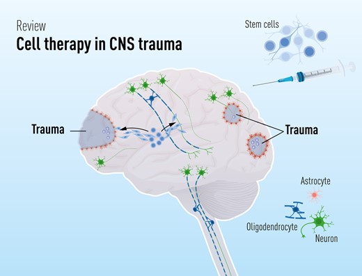 干細胞療法修復中樞神經系統創傷：4個原則—什么、何時、何地和為什么
