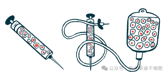 帕金森今日新聞：研究表明，低劑量TED-A9細胞療法可緩解帕金森病的運動癥狀
