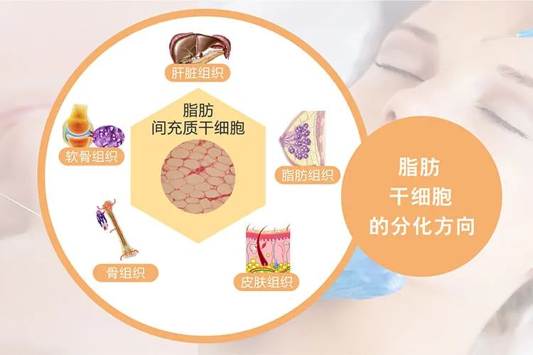 什么是脂肪干細胞：脂肪干細胞來源、臨床應用