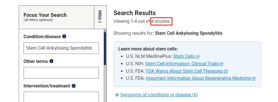 干細胞治療強直性脊柱炎臨床研究項目有4項 干細胞治療強直性脊柱炎臨床研究項目有4項