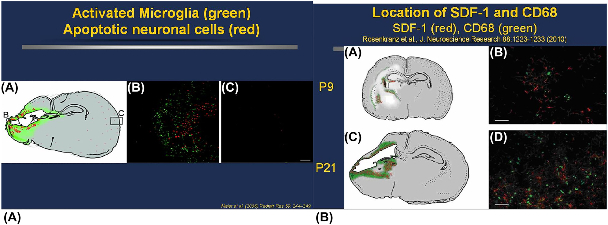 新生大鼠PN9和 PN21 HI后激活的小膠質(zhì)細(xì)胞和SDF-1表達(dá)