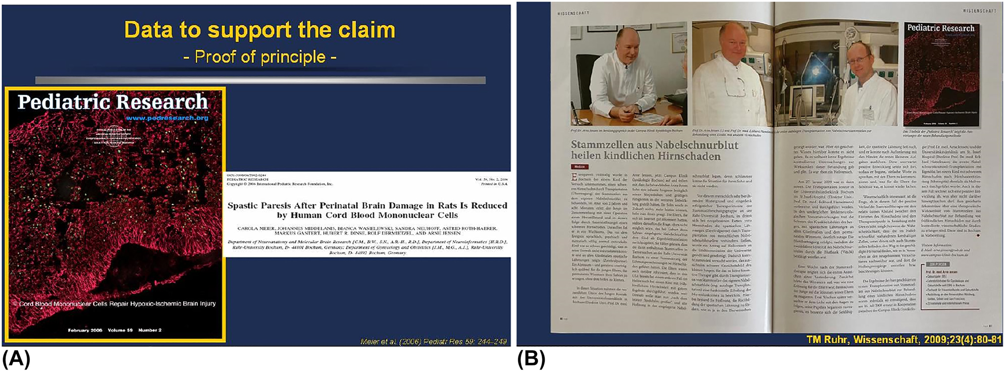 圖7：首次通過實(shí)驗(yàn)和臨床證明臍帶血MNC可潛在治愈腦性癱瘓。