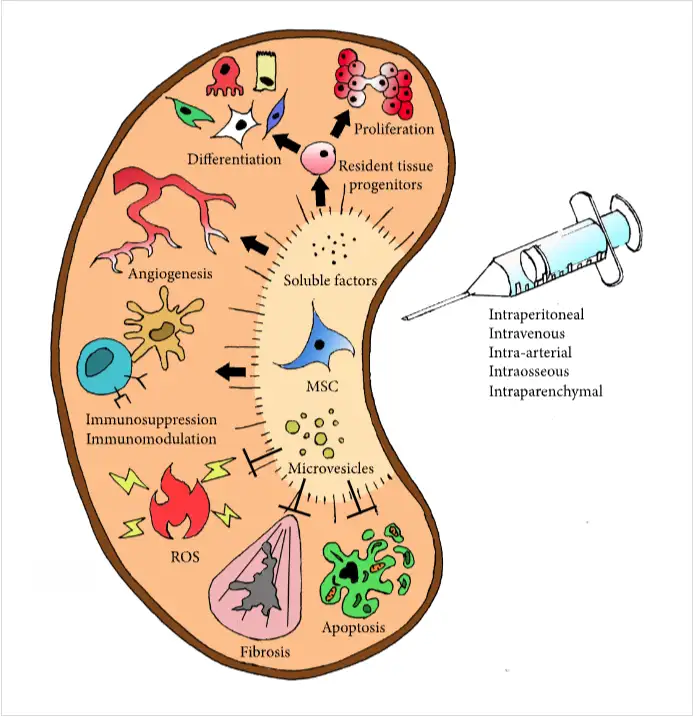 干細(xì)胞如何治療腎臟疾病? 干細(xì)胞如何治療腎臟疾病?