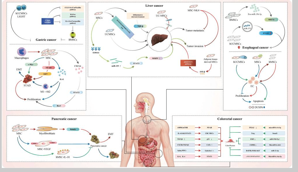 消化系統疾病如何治療？間充質干細胞治療的案例有哪些？