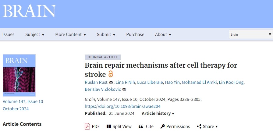 確認干細胞治療中風后的大腦修復機制，以推動干細胞治療中風進入臨床至關重要！