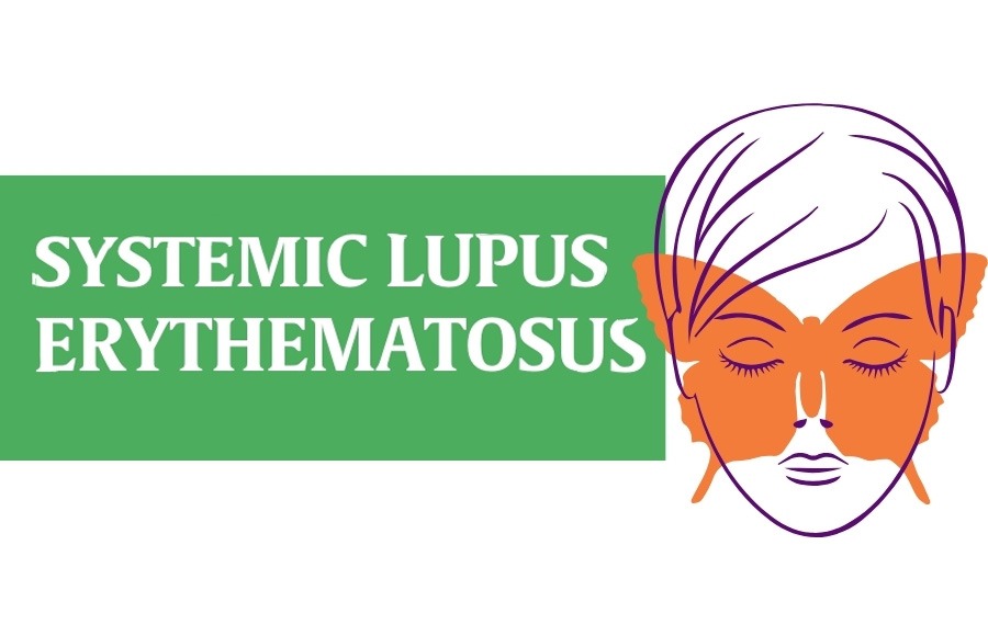 干細胞治療系統性紅斑狼瘡：2020-2024年臨床研究進展