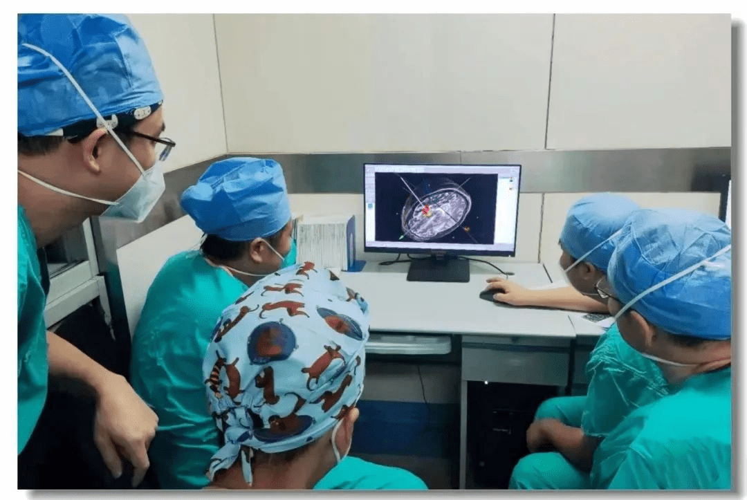 立體定向引導下神經干細胞移植術 立體定向引導下神經干細胞移植術