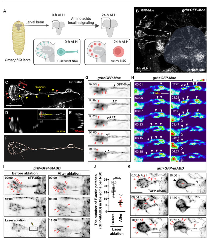圖2：靜息態(tài)神經(jīng)干細(xì)胞再激活過(guò)程中的F-肌動(dòng)蛋白結(jié)構(gòu)和動(dòng)力學(xué)