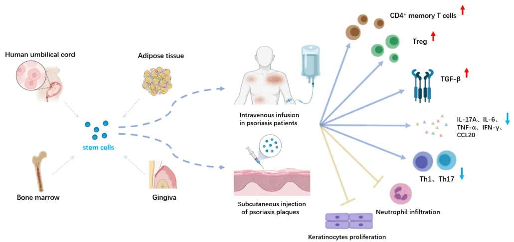 圖3：干細胞在銀屑病治療中的應用