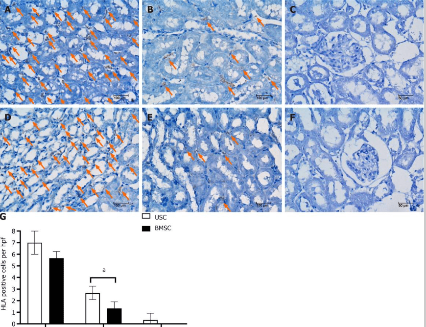 圖5:通過人類白細(xì)胞抗原免疫染色檢測急性腎損傷小鼠腎臟內(nèi)的尿液干細(xì)胞或骨髓間充質(zhì)干細(xì)胞 圖5:通過人類白細(xì)胞抗原免疫染色檢測急性腎損傷小鼠腎臟內(nèi)的尿液干細(xì)胞或骨髓間充質(zhì)干細(xì)胞