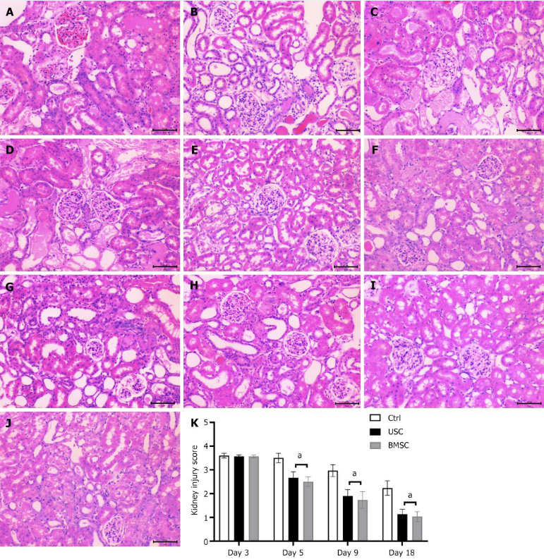 圖4:通過蘇木精和伊紅染色(200 ×)對尿液來源的干細(xì)胞治療、骨髓間充質(zhì)干細(xì)胞治療和對照未治療小鼠的急性腎損傷進(jìn)行組織學(xué)檢查。 圖4:通過蘇木精和伊紅染色(200 ×)對尿液來源的干細(xì)胞治療、骨髓間充質(zhì)干細(xì)胞治療和對照未治療小鼠的急性腎損傷進(jìn)行組織學(xué)檢查。