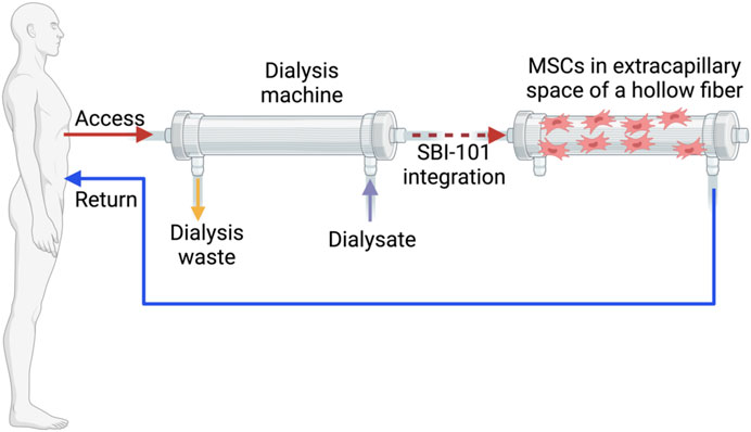 圖1：配備集成SBI-101系統的體外回路。