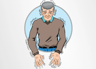 從短期緩解到長(zhǎng)期穩(wěn)定:干細(xì)胞移植治療帕金森病的療效持續(xù)時(shí)間研究 從短期緩解到長(zhǎng)期穩(wěn)定:干細(xì)胞移植治療帕金森病的療效持續(xù)時(shí)間研究