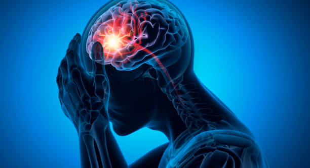 神經干細胞移植：成為治療早期缺血性中風時間窗困境的關鍵策略