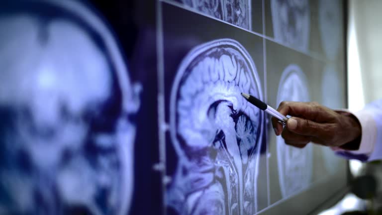 綜述:談談間充質干細胞治療中風的機制、案例及未來發展方向 綜述:談談間充質干細胞治療中風的機制、案例及未來發展方向