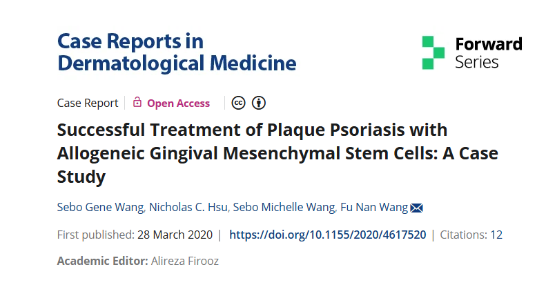 同種異體牙齦間充質干細胞成功治療斑塊性銀屑病：案例研究