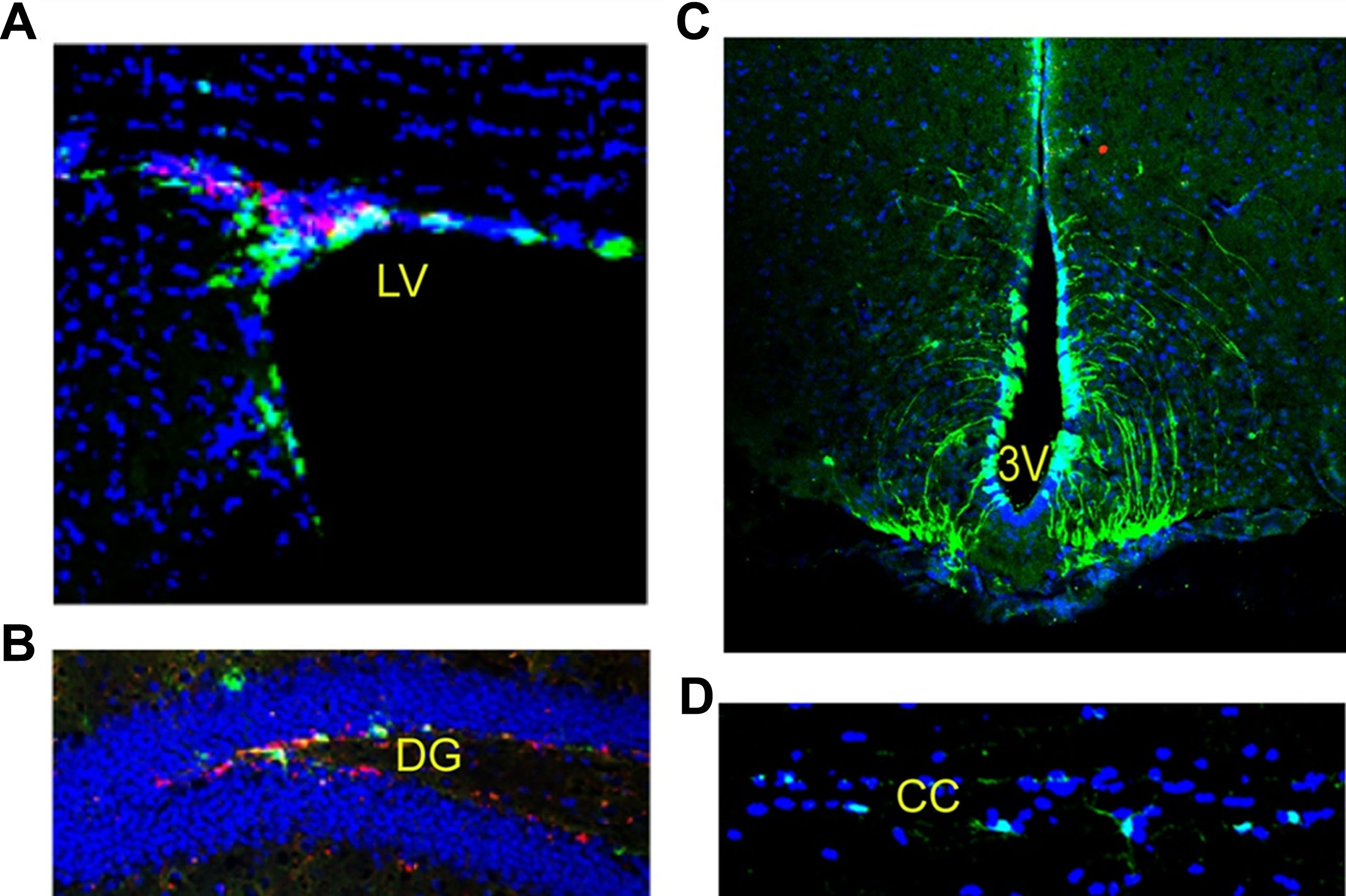 圖2：成年小鼠腦和脊髓中的神經干細胞：左腦 (LV)、第三腦室 (DG)、齒狀回 (DG) 和脊髓。