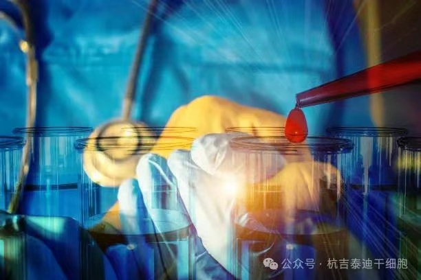 一名RA/MS患者經過CAR-T治療失敗后，經過自體干細胞移植后，主觀健康狀態顯著改善！