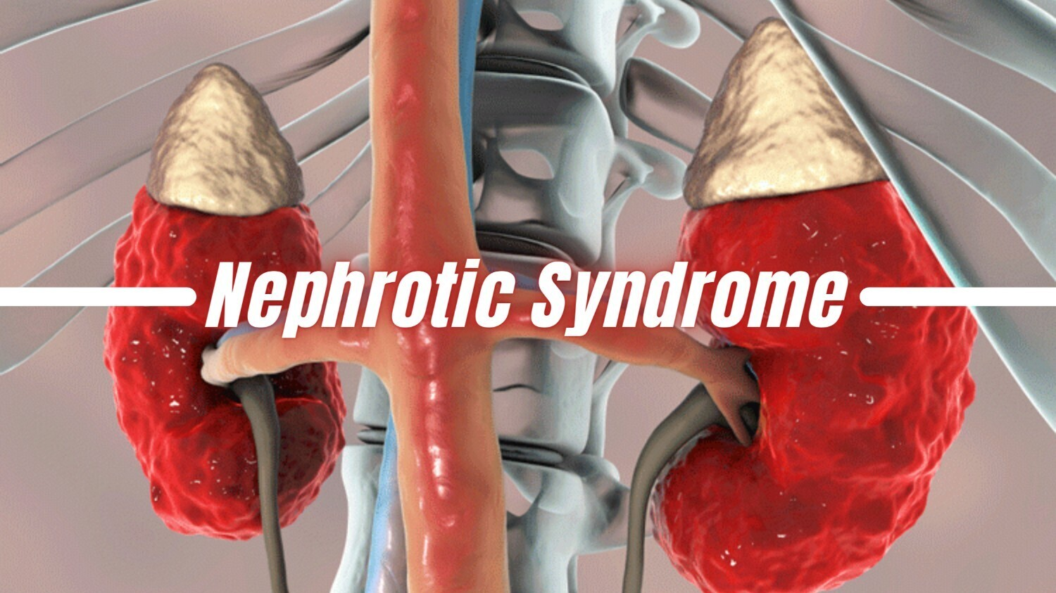 2022-2025年干細胞治療腎病綜合征最新臨床研究進展