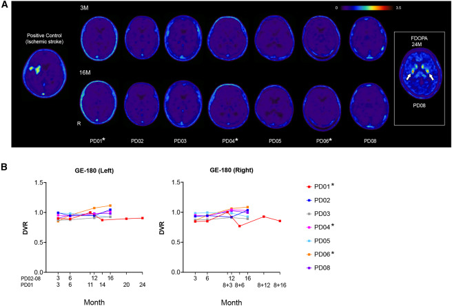 圖2：移植對象和對照對象的[18F]GE180PET掃描結(jié)果