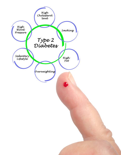 哪些人適合干細胞治療2型糖尿病？專家公布5大評估標準