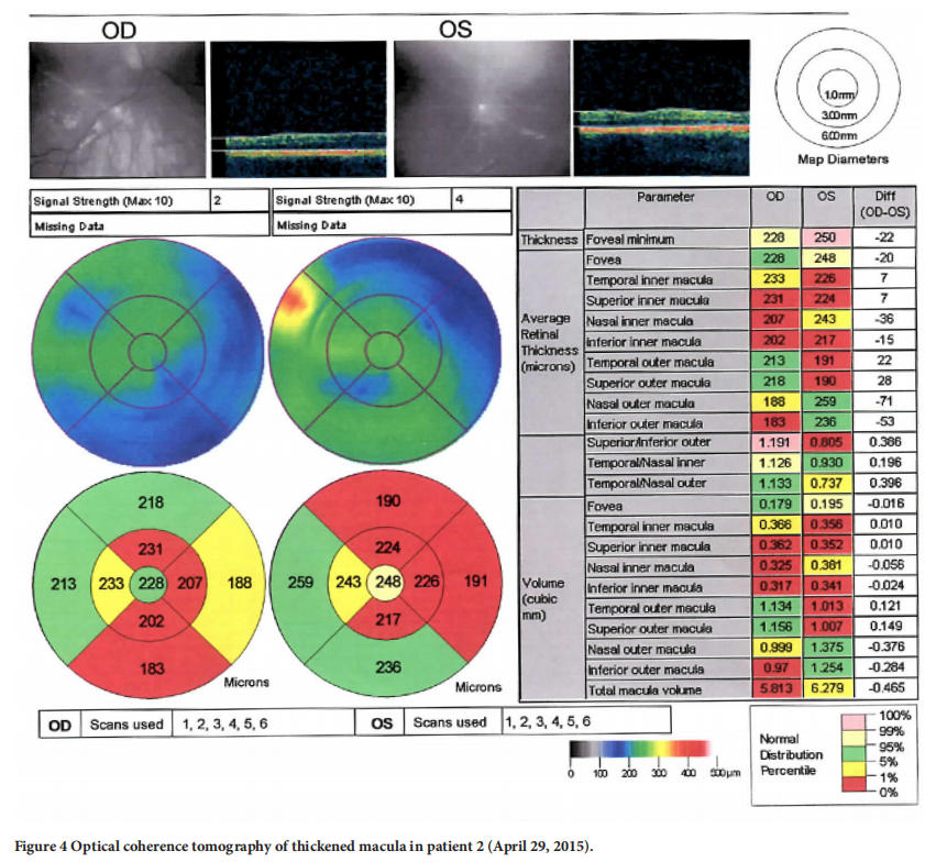 遺傳性視神經病變臨床試驗