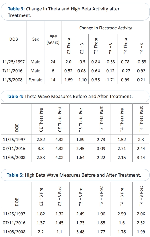 干細胞治療自閉癥 干細胞治療自閉癥