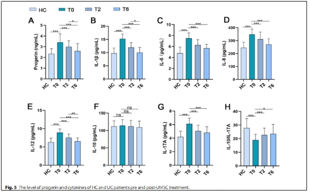 圖5 HC和UC思者在UMSC治療前后的progerin和細(xì)胞因子水平 圖5 HC和UC思者在UMSC治療前后的progerin和細(xì)胞因子水平