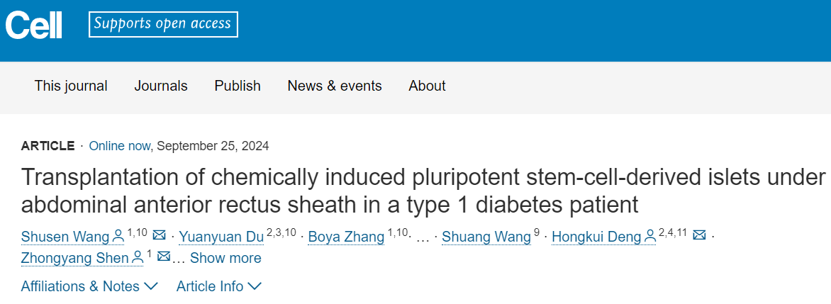 在一名1型糖尿病患者腹部前直肌鞘下移植化學(xué)誘導(dǎo)的多能干細(xì)胞來源胰島
